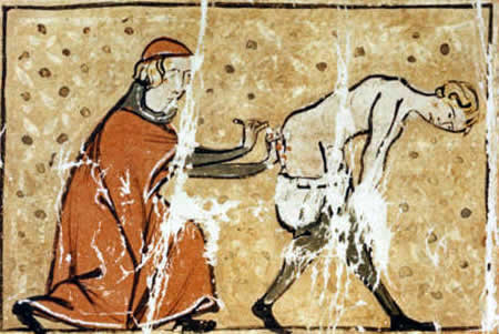 4. Раскалённое железо против геморроя. медицина, средние века
