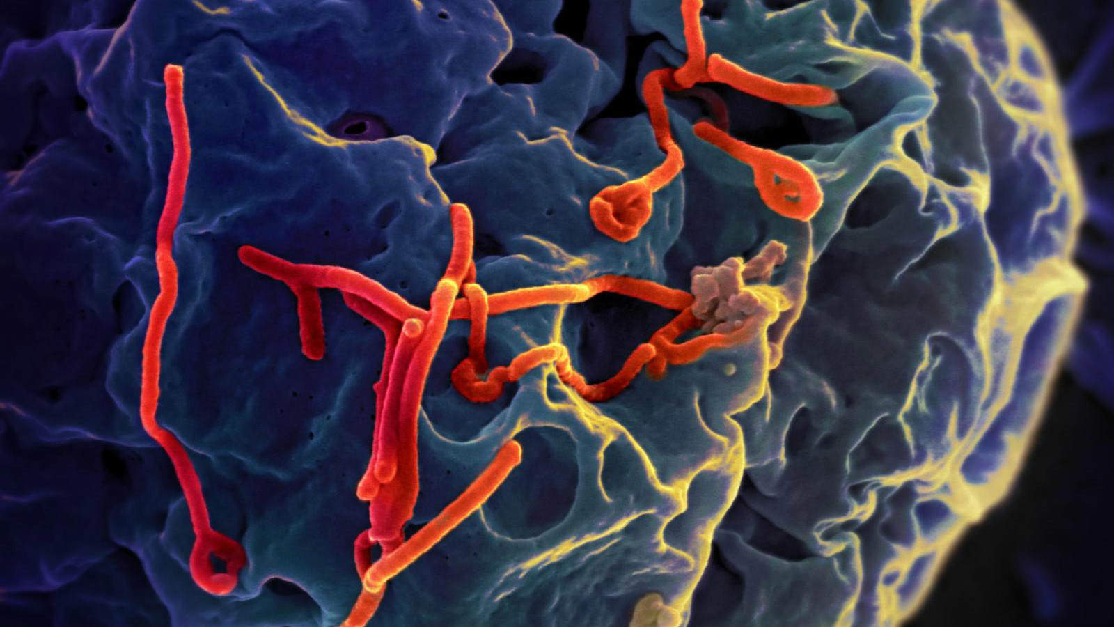 Вирус Эбола. болезни, вирусы, история, эпидемия