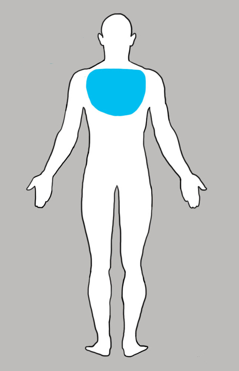 4. Боль в верхнем отделе спины боль, люди, тело