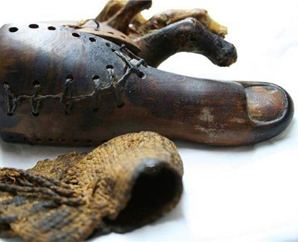 2. Протез пальца ноги (3000 лет) археология, история, находки, факты