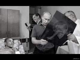 Старший брат во время ссоры воткнули младшему нож в лицо