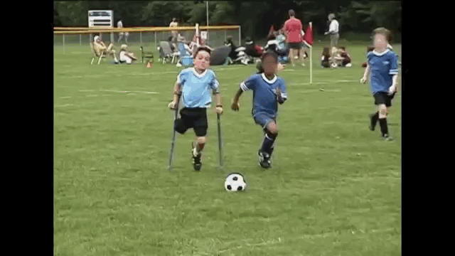 This Teenager Was Born With One Leg But... This Teenager Was Born With One Leg But...