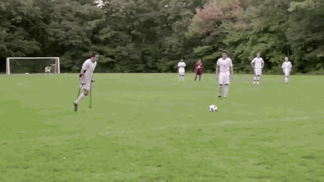 This Teenager Was Born With One Leg But... This Teenager Was Born With One Leg But...