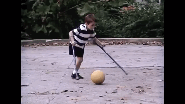 This Teenager Was Born With One Leg But... This Teenager Was Born With One Leg But...