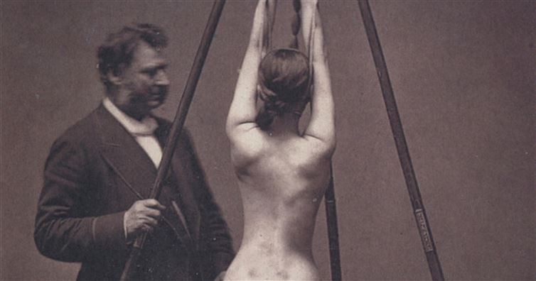 These 18 Vintage Medical Photos Are Both Creepy And Fascinating