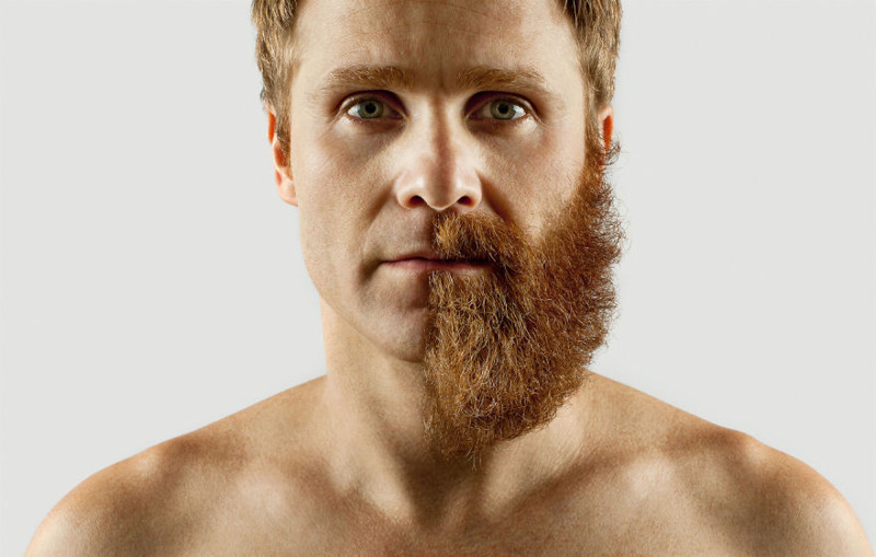 Artist Completes His Half-Shaved Hipster Beard With Random Objects