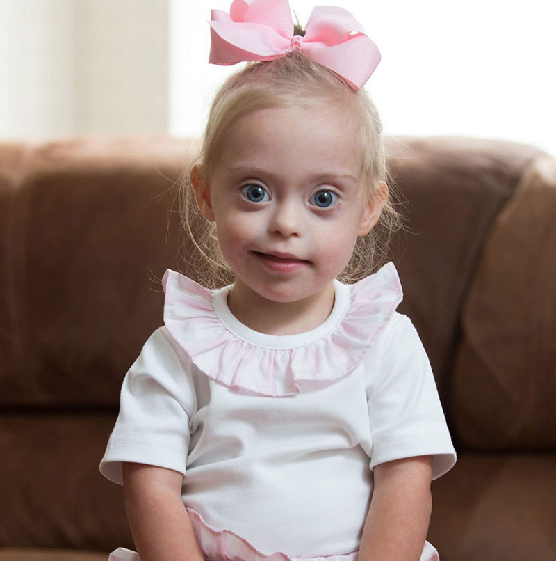 2-Year-Old Girl With Down Syndrome Wins Modeling Contract