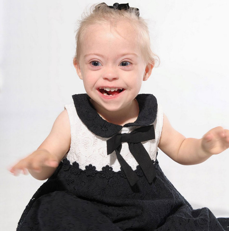 2-Year-Old Girl With Down Syndrome Wins Modeling Contract