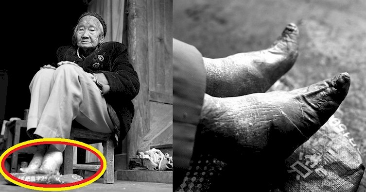 These Are The Last Women With Bound Feet In China