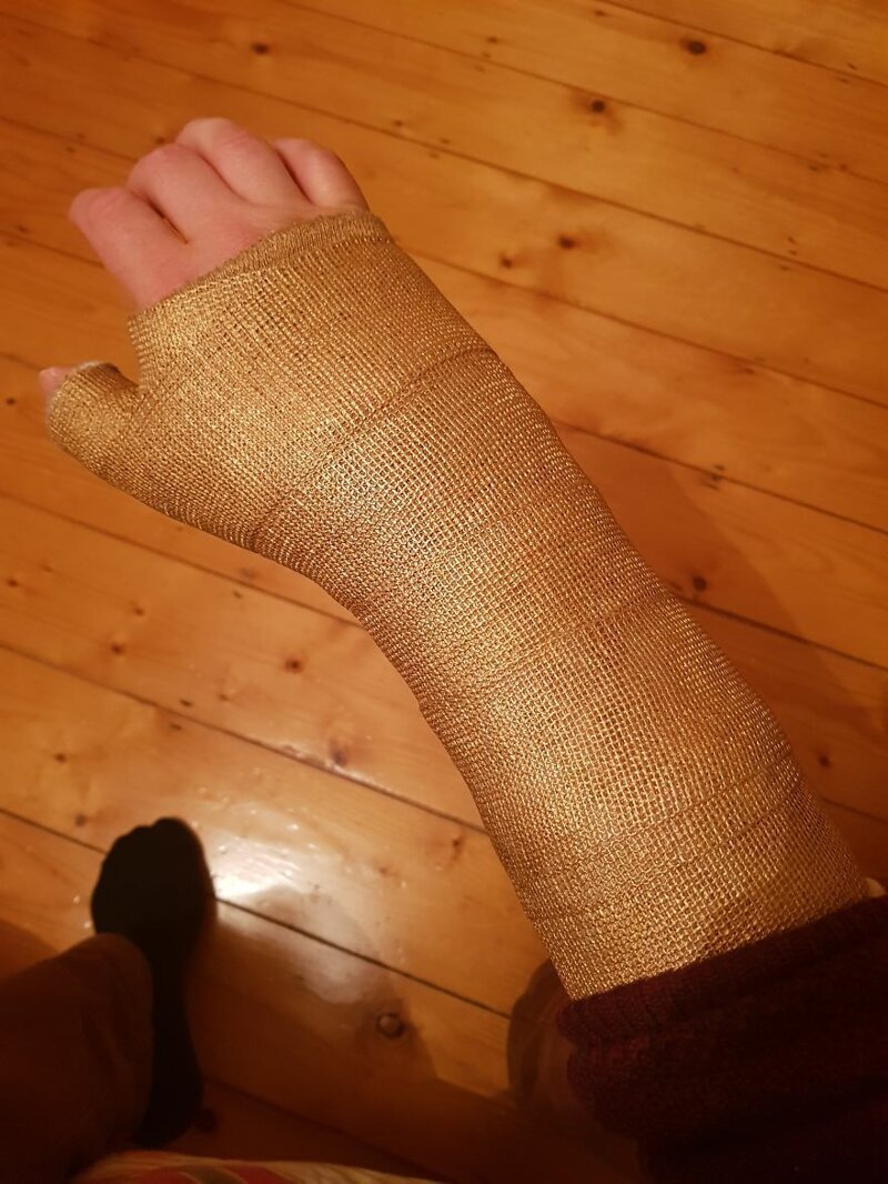 The first step was turning my cast to gold. I just used gold metallic acrylic paint.