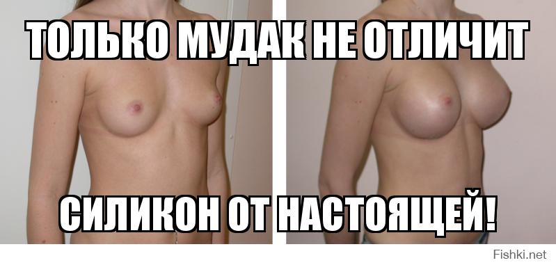 отличие настоящих сисек от силиконовых даваха