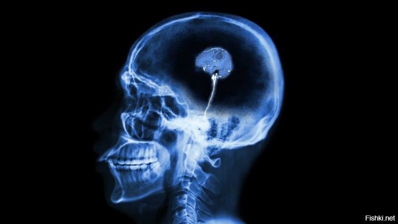 У чувака вместо мозга грецкий орех. Максимум