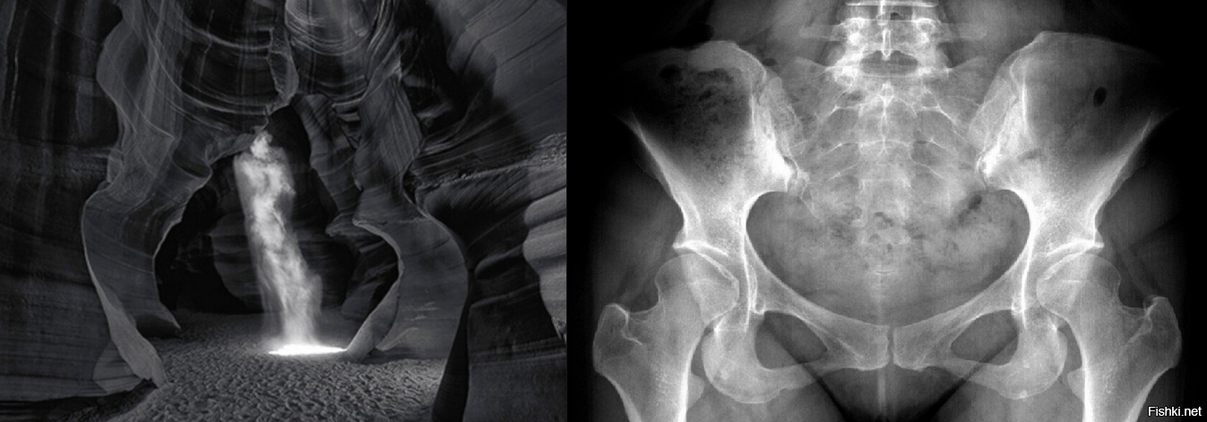 Фантом" Питера Ликома (6,5 миллионов долларов)
Рентгенография тазобедренного сустава (1050 руб.)
