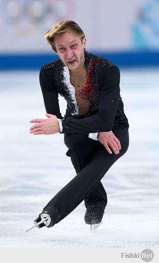 Этот "смешной" человек завоевал олимпийское золото будучи фактическим инвалидом. У него половина спины из металла. Сегодня метелл сломался и он не смог выступать-"нечем было выступать". Но он герой России.